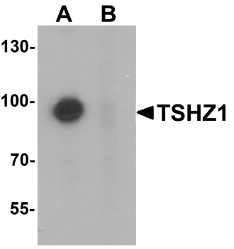 TSHZ1 Antibody