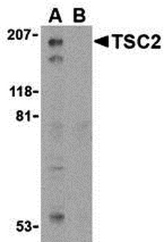 TSC2 Antibody