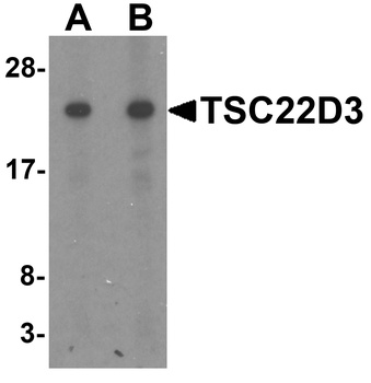 TSC22D3 Antibody