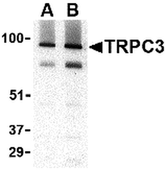 TRPC3 Antibody
