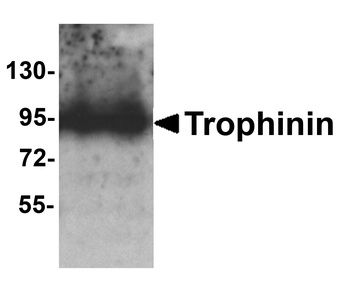 Trophinin Antibody