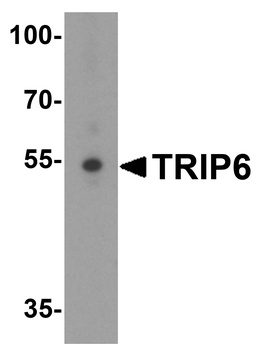 TRIP6 Antibody