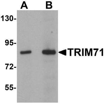 TRIM71 Antibody