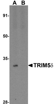TRIM5 Antibody