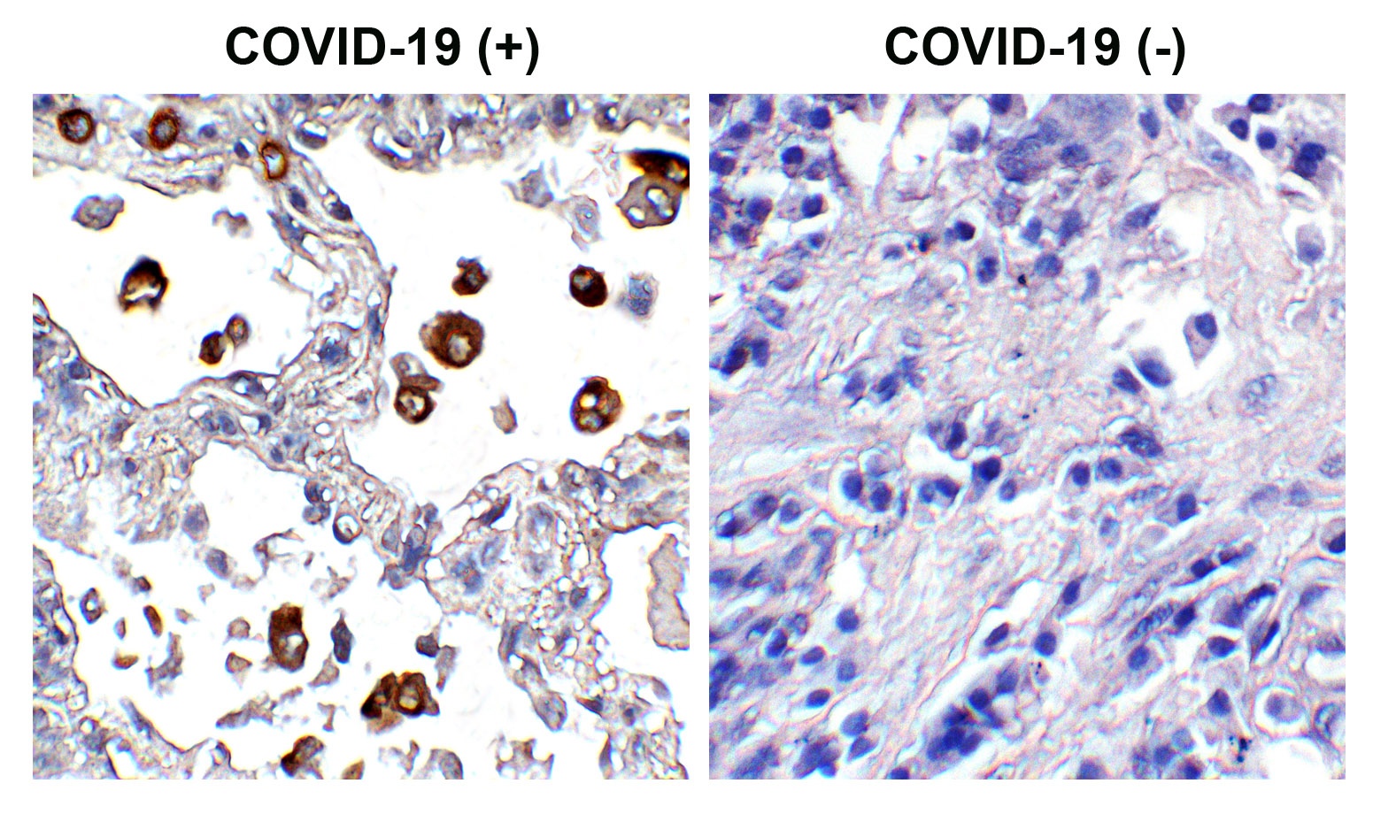 SARS-CoV-2 (COVID-19) Spike S2 Antibody [5E6]