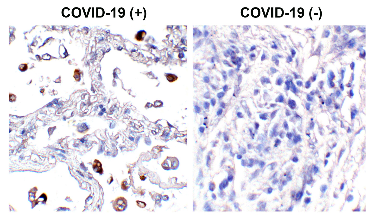 SARS-CoV-2 (COVID-19) Spike S2 Antibody [4F10]