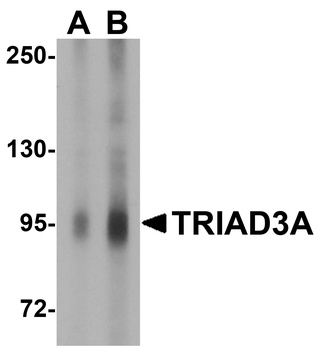RNF216 Antibody