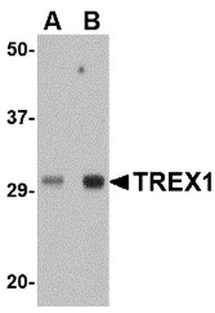 TREX1 Antibody