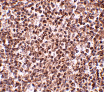 TREX1 Antibody