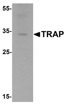ACP5 Antibody