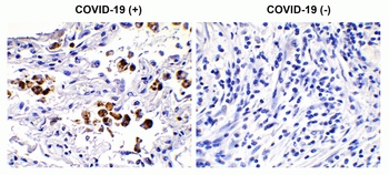 SARS-CoV-2 (COVID-19) Spike S2 Antibody