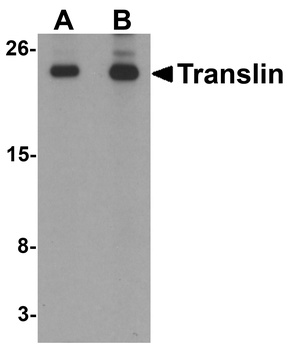 TSN Antibody