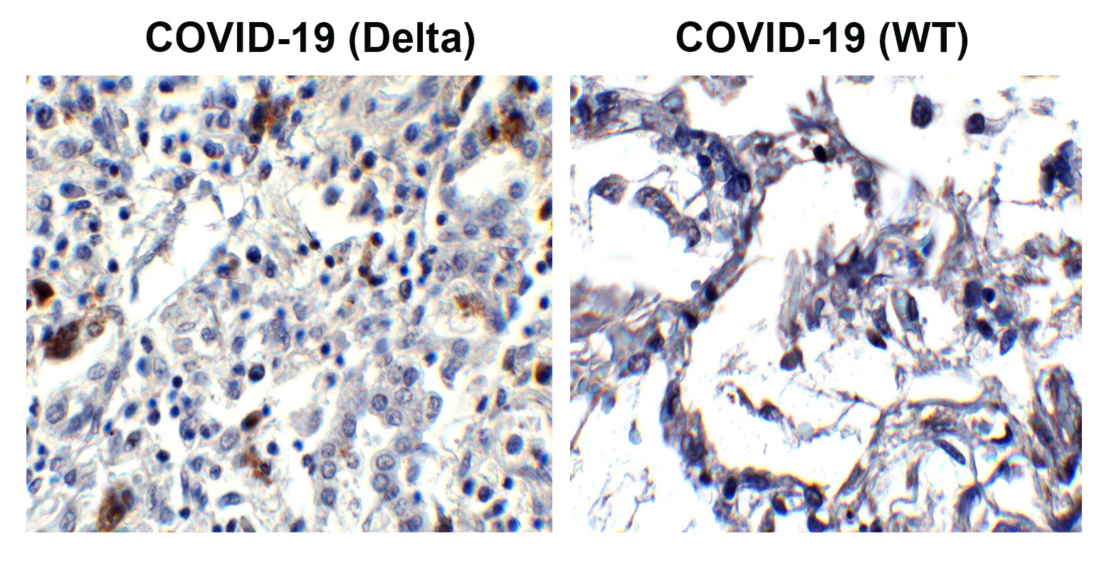 SARS-CoV-2 (COVID-19) Spike P681R Antibody [7E3C5] (Delta Variant)