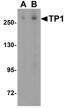 TEP1 Antibody