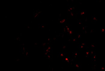 TEP1 Antibody