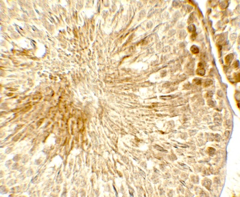 TOPAZ1 Antibody