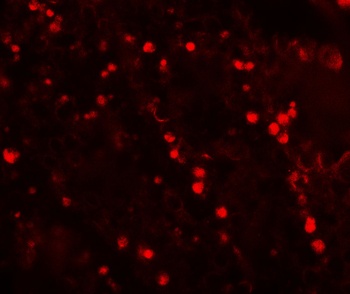 TOPAZ1 Antibody