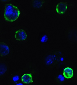 SARS-CoV-2 (COVID-19) Spike Antibody (cleavage site)