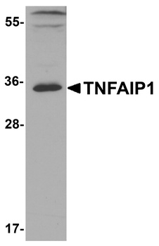 TNFAIP1 Antibody