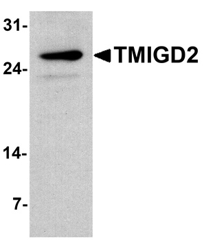 TMIGD2 Antibody