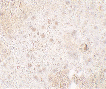 TMIGD1 Antibody
