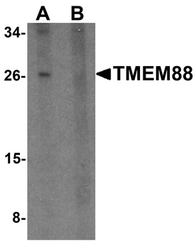 TMEM88 Antibody