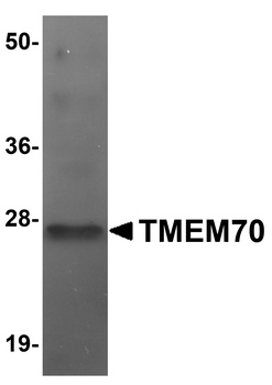 TMEM70 Antibody