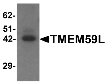 TMEM59L Antibody