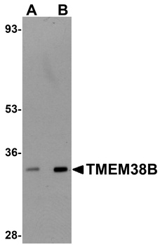TMEM38B Antibody