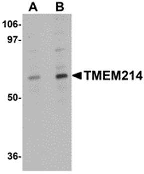 TMEM214 Antibody