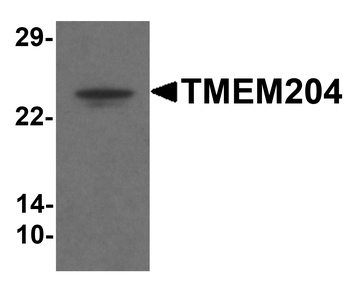 TMEM204 Antibody