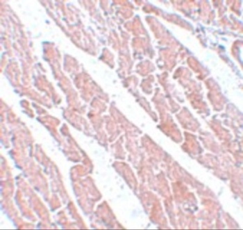 TMEM184C Antibody