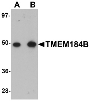 TMEM184B Antibody