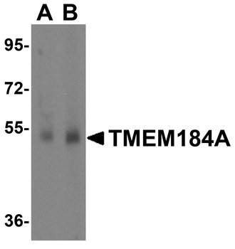 TMEM184A Antibody