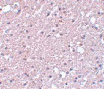 TMEM184A Antibody