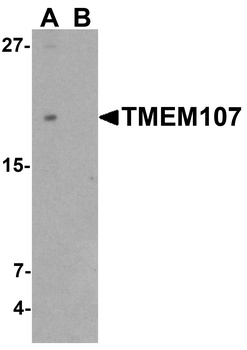 TMEM107 Antibody