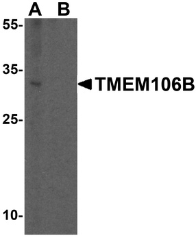 TMEM106B Antibody