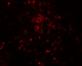 TLX3 Antibody