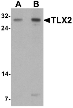 TLX2 Antibody