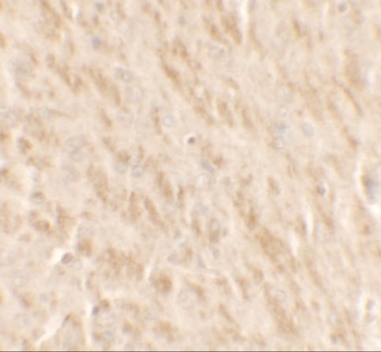 TLX2 Antibody