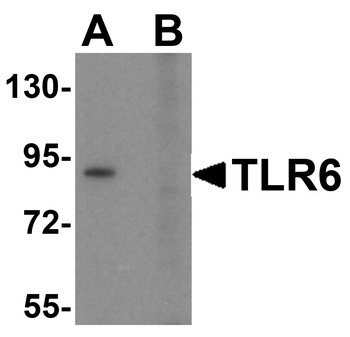 TLR6 Antibody