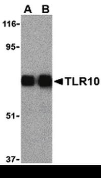 TLR10 Antibody