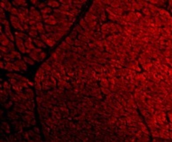 TIRAP Antibody