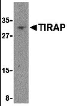 TIRAP Antibody