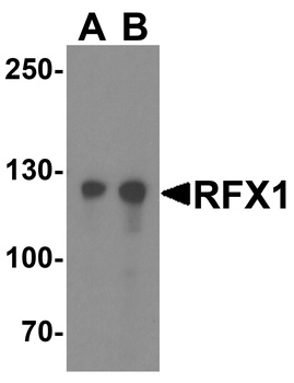RFX1 Antibody