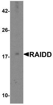 RAIDD Antibody