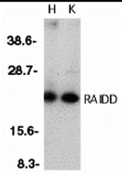RAIDD Antibody