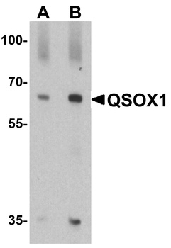 QSOX1 Antibody