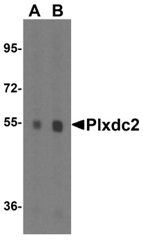 PLXDC2 Antibody