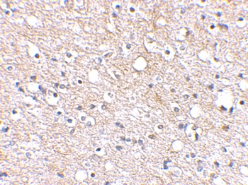 PLXDC2 Antibody